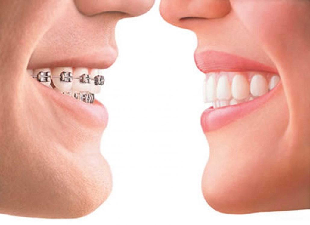 Cirugia dental
